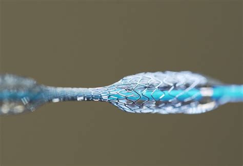 ¡Nitinol: Descubriendo el Futuro de la Flexibilidad en Aplicaciones Biomédicas!